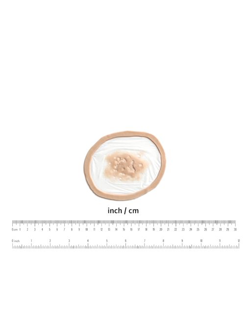 Small Gunshot Wound Prosthetic - Image 2